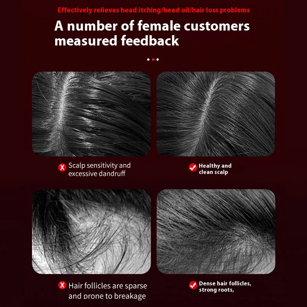 Electric Massage Comb with Vibration Red Light Therapy Scalp Brush Hair Growth Anti-Hair Loss Liquid Oil Applicator Hair Care