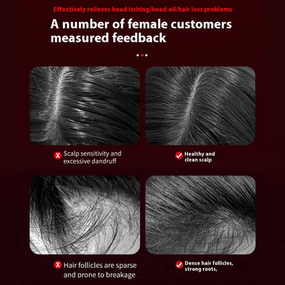 Electric Massage Comb with Vibration Red Light Therapy Scalp Brush Hair Growth Anti-Hair Loss Liquid Oil Applicator Hair Care